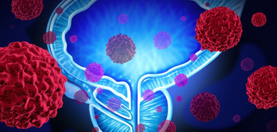 odoreader-prostate-1