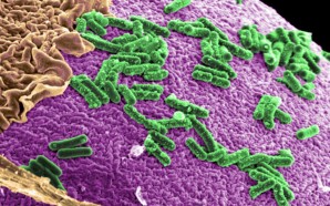 microbiome-0099