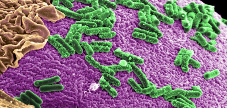 microbiome-0099