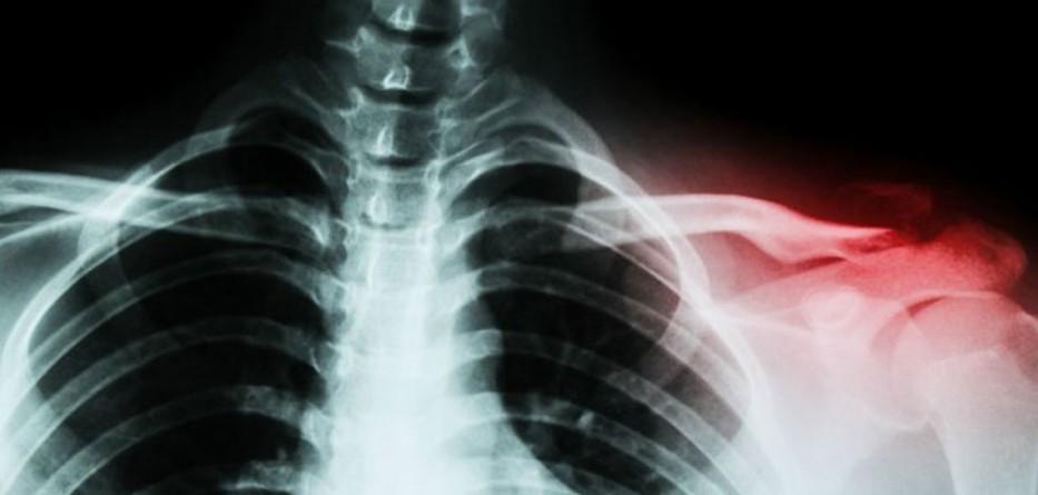 Bone_web_1024