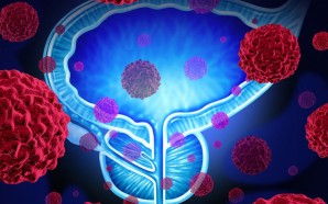 odoreader-prostate-1